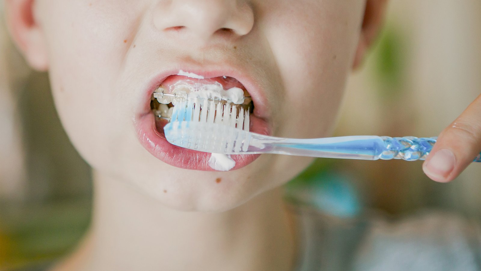 Pouvez-vous utiliser une brosse à dents électrique avec un appareil dentaire : l'image montre un garçon se brossant les dents avec un appareil dentaire