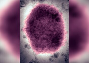 Les cas de monkeypox doublent au Royaume-Uni et apparaissent aux États-Unis