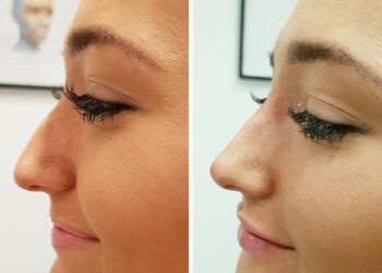 L’image peut contenir la peau et la mâchoire du visage de la personne humaine
