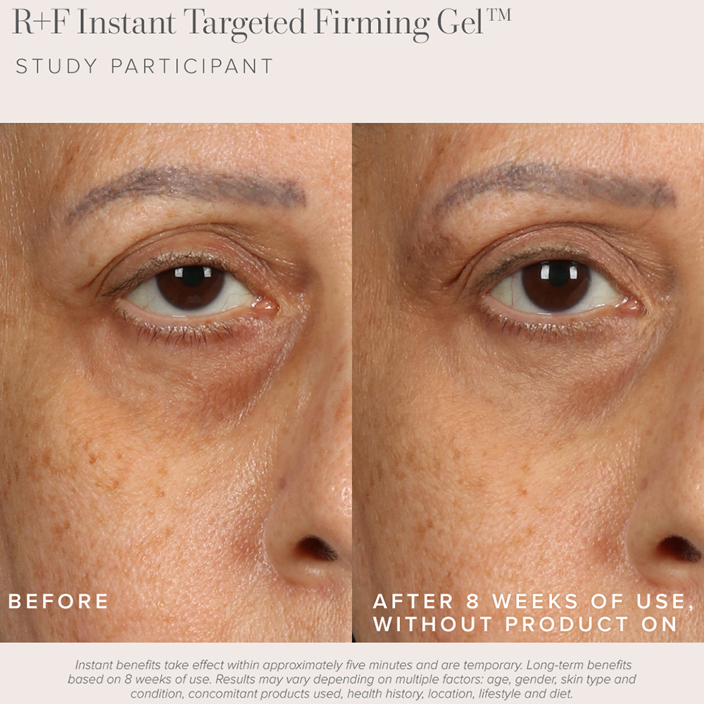 Le nouveau gel raffermissant ciblé instantané de Rodan + Fields fait disparaître mes poches sous les yeux