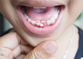 Qu'est-ce qui cause le saignement des gencives?  |  Sciences en direct