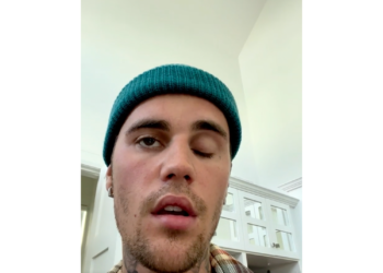 Derrière l'état de santé qui a causé la paralysie faciale de Justin Bieber