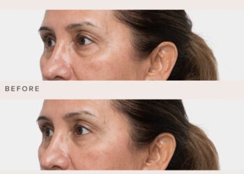 Le nouveau gel raffermissant ciblé instantané de Rodan + Fields fait disparaître mes poches sous les yeux