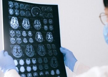 Les médicaments utilisés pour traiter le TDAH pourraient aider à traiter les symptômes de la maladie d'Alzheimer