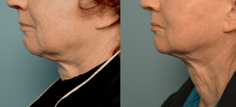 Cette ligne produit des avantages incroyables après un traumatisme facial ou une exposition aux radiations