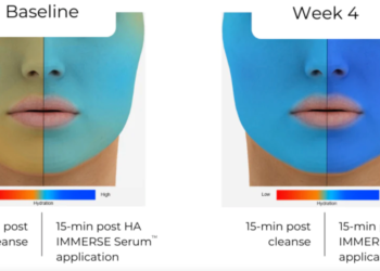 Ce sérum à l'acide hyaluronique primé change la donne pour les peaux sèches