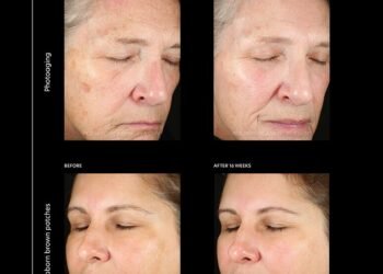 Ce sérum anti-taches aide à atténuer la décoloration en 4 semaines