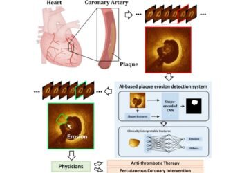 This New AI-Based Technique Can Detect Heart Conditions, May Help Avert Heart Attacks