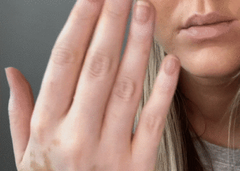 L'image peut contenir de la peau Personne humaine Mâchoire et tête