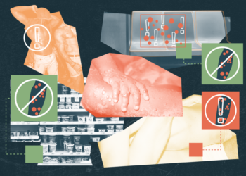 Monkeypox se propage.  Voici comment l'éviter.