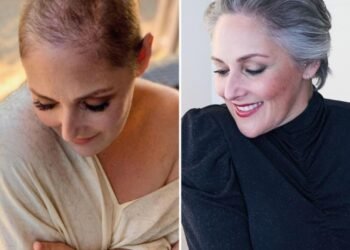Ricki Lake partage son impressionnante transformation après des années de lutte contre la perte de cheveux