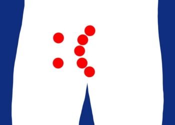 Traitements Monkeypox qui peuvent aider les plaies douloureuses sur les fesses, les organes génitaux et la bouche