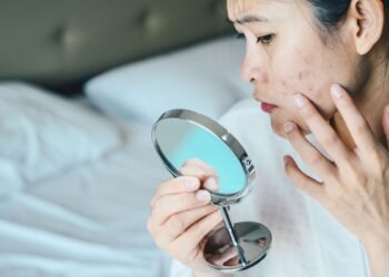 Les produits laitiers causent-ils de l'acné?  |  Sciences en direct