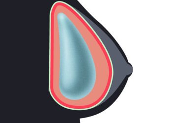 Avertissement de la FDA Un rappel des risques pour la santé