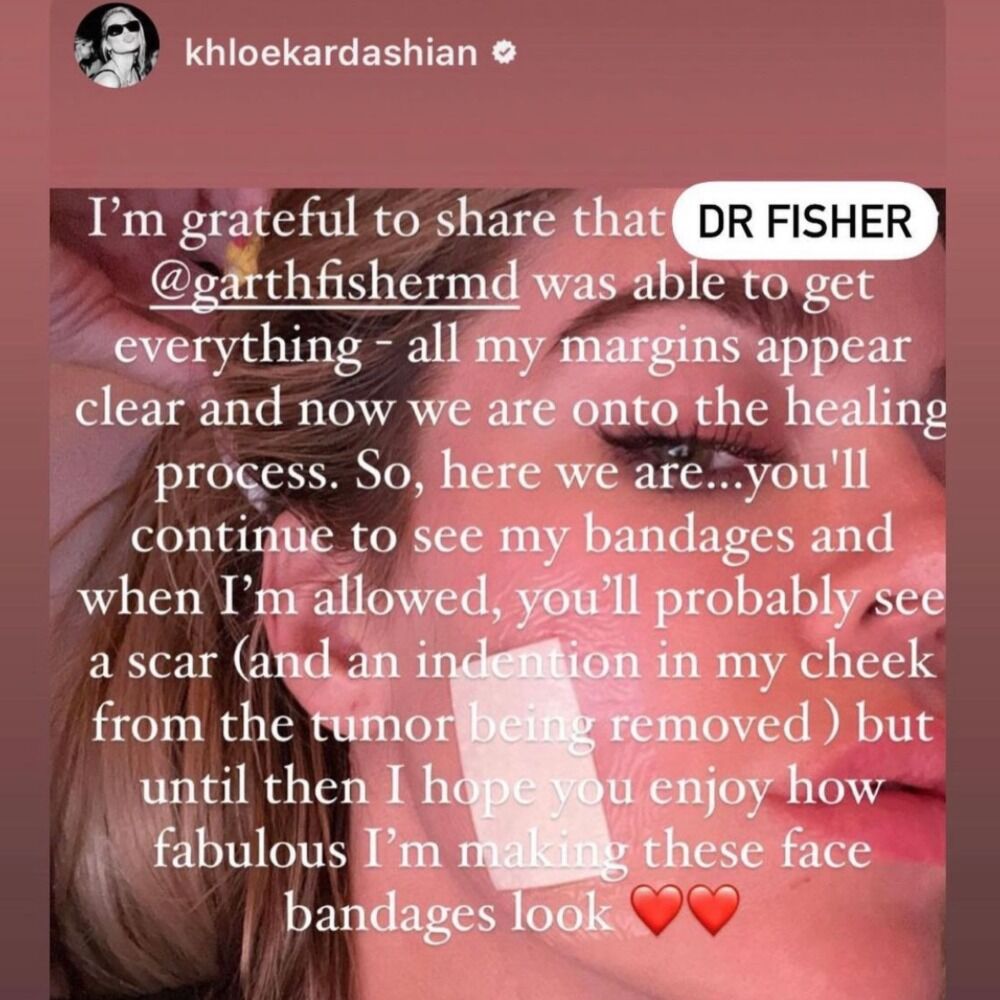 Khloé Kardashian a subi une intervention chirurgicale d'urgence pour retirer une tumeur "rare" de son visage – Thebuzzly