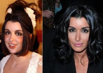 Complexée par son physique, Jenifer se confie sur son expérience de la chirurgie esthétique