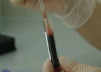 Les scientifiques développent un test pour prédire quand vous mourrez