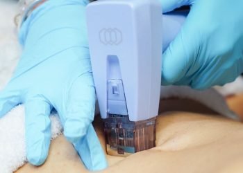 Les différences entre les traitements de microneedling par radiofréquence les plus populaires