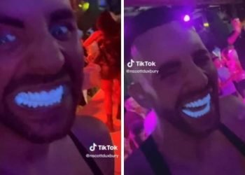 influenceur refait dent turquie fluo