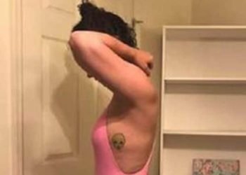 Cette jeune femme a été expulsée de la piscine de sa résidence, car son maillot de bain pouvait "exciter les ados"...