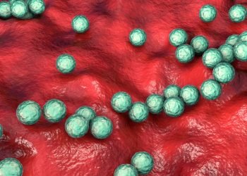 Une infection streptococcique dangereuse qui augmente au Royaume-Uni pourrait se propager aux États-Unis