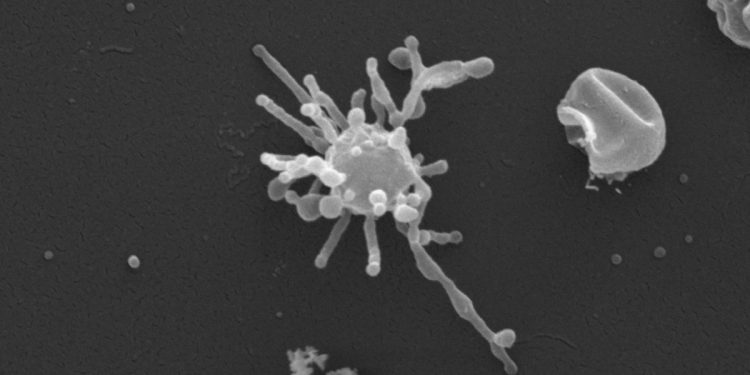 Un microbe tentaculaire massif peut être l'ancêtre direct de toute vie complexe