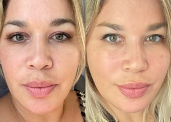 Ce qui a le mieux fonctionné pour ma peau à 45 ans