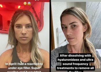 Christina Hall repense les implants et les charges après des problèmes de santé