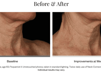 Les dermes adorent cette crème pour le cou pour lisser les rides - il suffit de regarder les avant et après