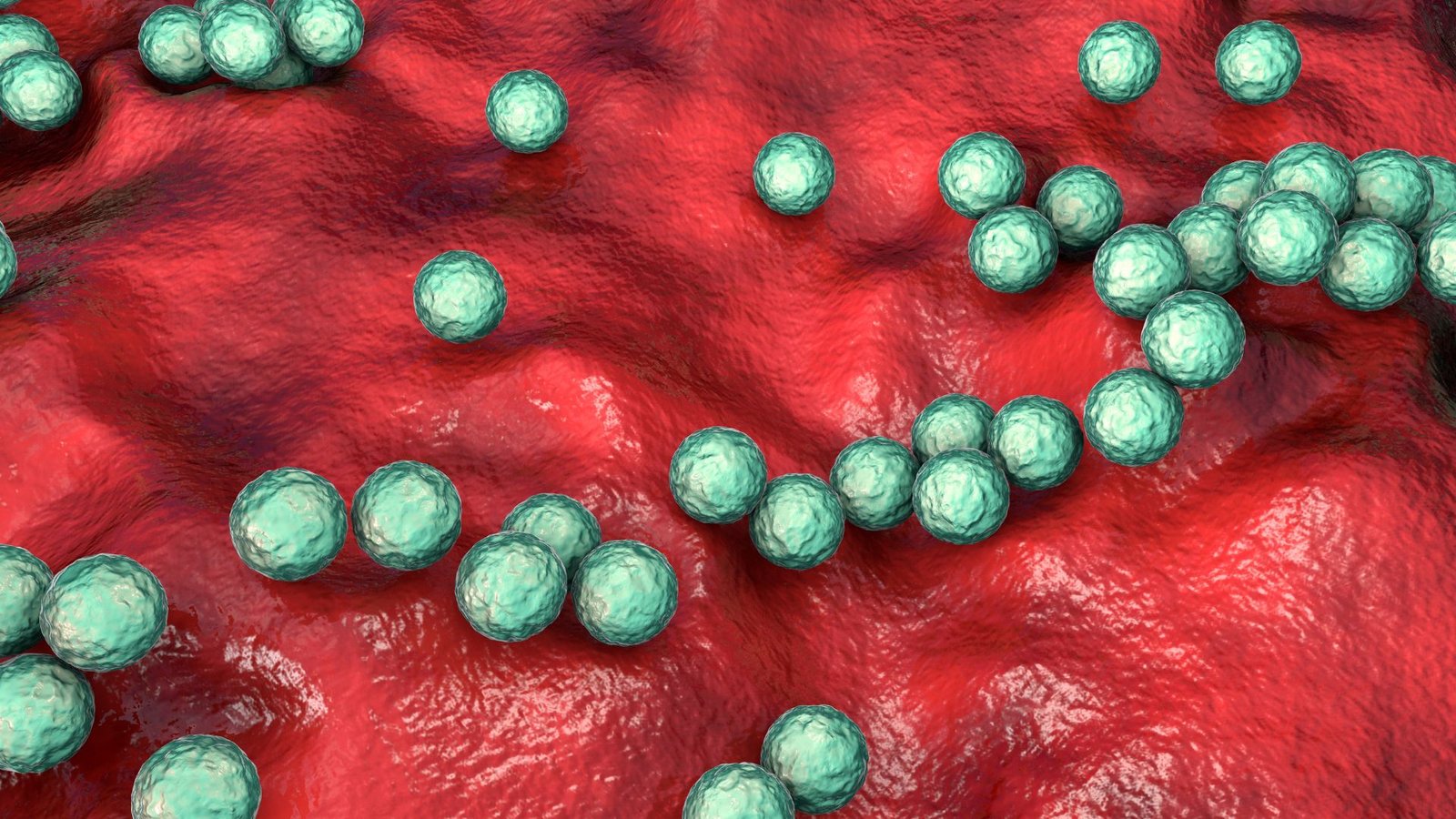 Une infection streptococcique dangereuse qui augmente au Royaume-Uni pourrait se propager aux États-Unis
