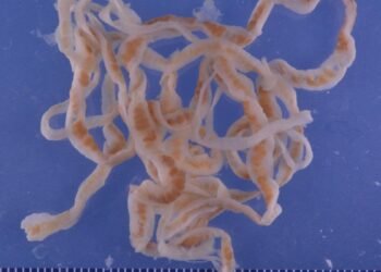 Il a un ténia de 1,7 mètre dans l'estomac après avoir abusé du sashimi