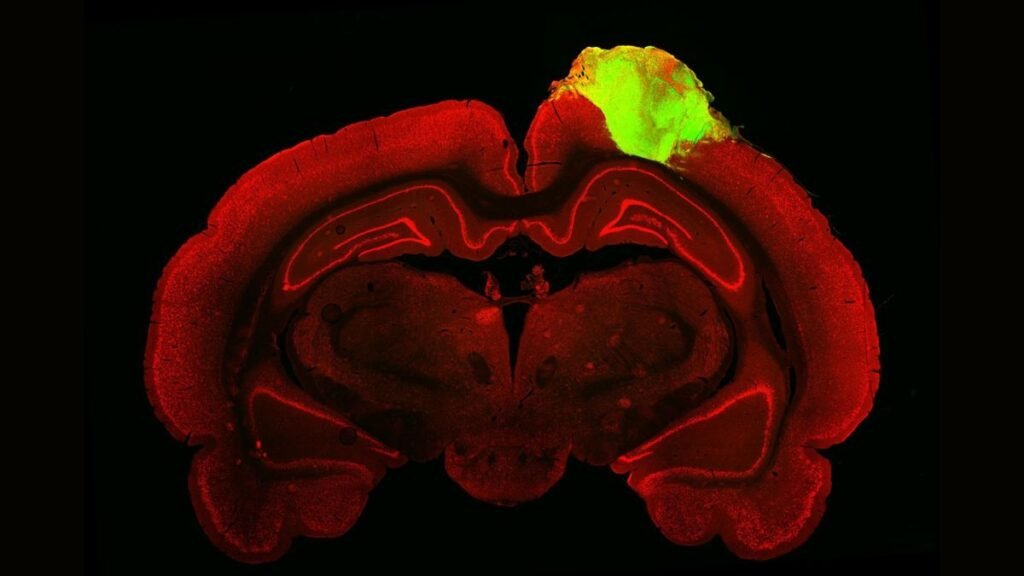 Des lésions cérébrales de rat « branchées » avec des mini-cerveaux humains cultivés en laboratoire lors d'une première expérience mondiale – Thebuzzly