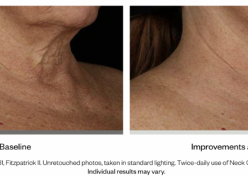 Les critiques disent que cette crème pour le cou fait "disparaître les rides"