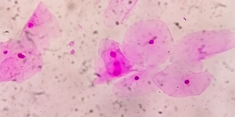 Qu est ce Que Le Microbiote Vaginal