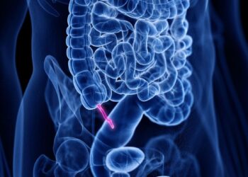 Appendicite : causes, symptômes et traitement