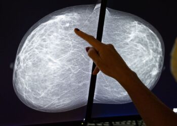 Les patientes noires peuvent avoir besoin de dépistages du cancer du sein plus tôt que ce que recommandent de nombreuses directives