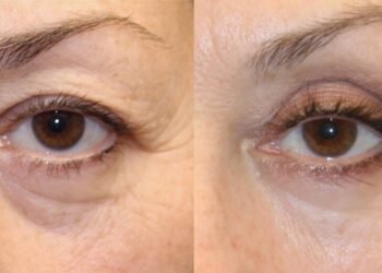 Le meilleur maquillage, soins de la peau et procédures pour les yeux d'apparence plus jeune