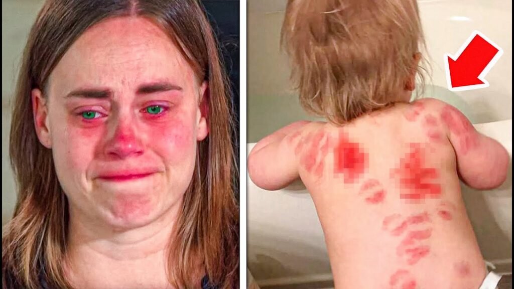 Mom Ignores Pimple on Son’s Back, What Happens Next Is Shocking – Thebuzzly