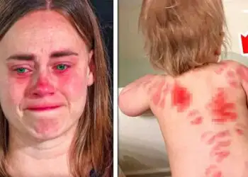 Mom Ignores Pimple on Son’s Back, What Happens Next Is Shocking