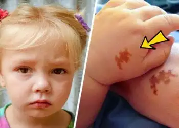 Mom adopts girl with same birthmark as her's, doing a test she was shocked 