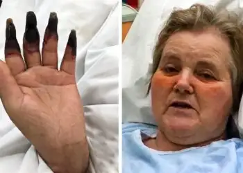 After Cleaning Her House for 2-Hours Straight - She Notices Her Fingers Turning Black