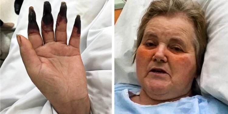 After Cleaning Her House for 2-Hours Straight - She Notices Her Fingers Turning Black – Thebuzzly