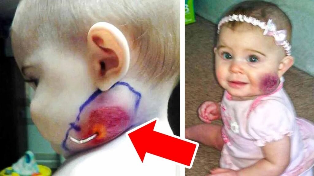 Mom Spots String Growing Out of Baby's Face, Doctors Were Shocked To Find This... – Thebuzzly