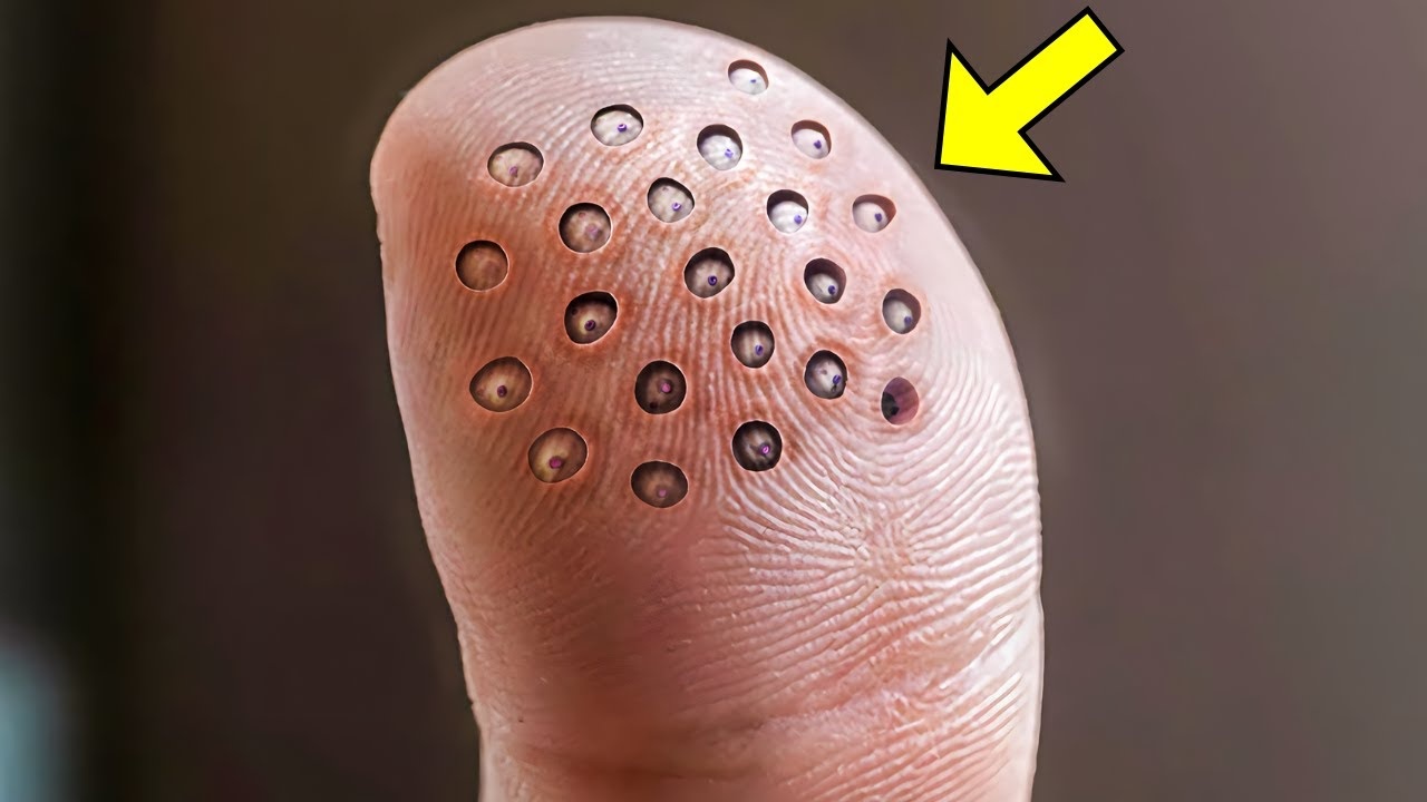 man-has-weird-round-spots-on-finger-when-the-doctors-see-it-they-call