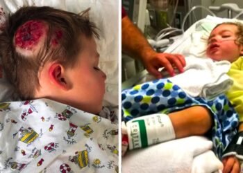 This Little Boy Was Shaky After Hitting His Head. Then Doctors Made An Alarming Discovery