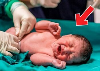 A woman gives birth to a baby girl - Then the doctor notices something strange