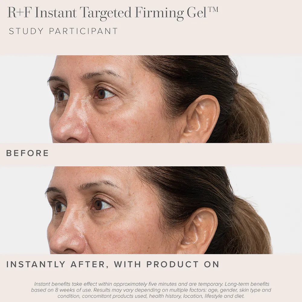 Le nouveau gel raffermissant ciblé instantané de Rodan + Fields fait disparaître mes poches sous les yeux