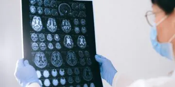 Les médicaments utilisés pour traiter le TDAH pourraient aider à traiter les symptômes de la maladie d'Alzheimer