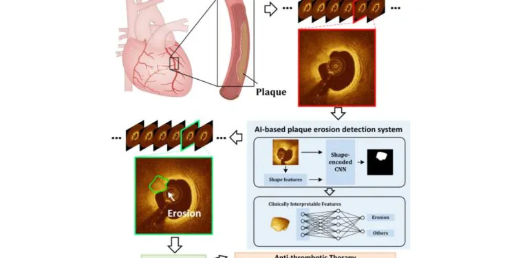 This New AI-Based Technique Can Detect Heart Conditions, May Help Avert Heart Attacks