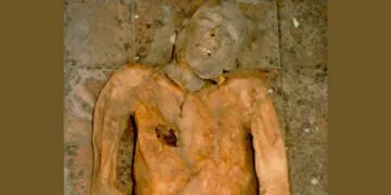 Genome of E.Coli Bacterium Reconstructed Using Gallstone From 600-Year-Old Mummy